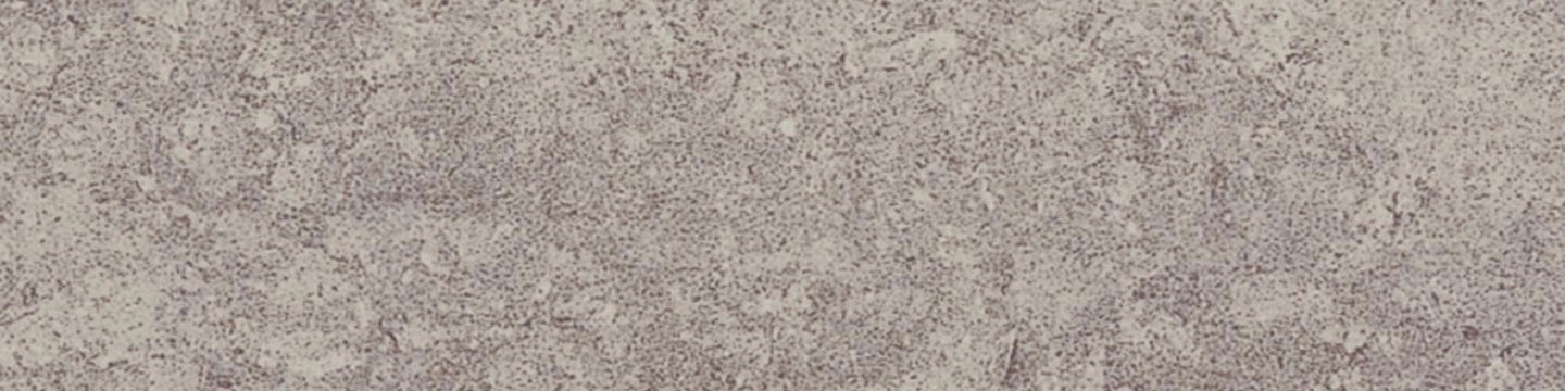 Casalgrande Padana, Marte - Raggio Di Luna, Naturale, 15x15cm, 9.40mm, Rett.